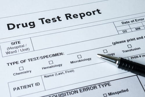 does cbd show up on a drug test